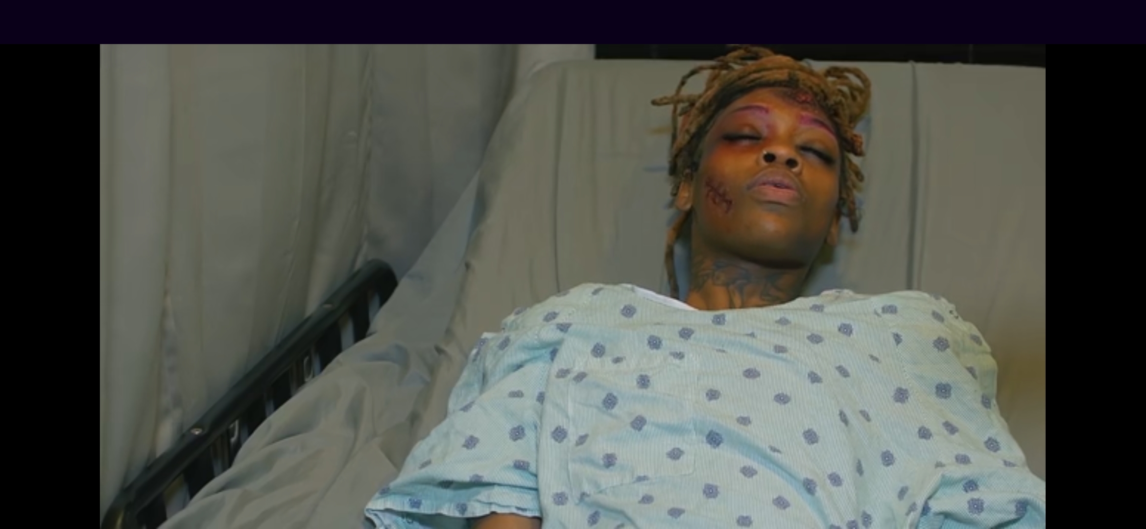 Person lying in hospital bed wearing a hospital gown, looking at the camera.