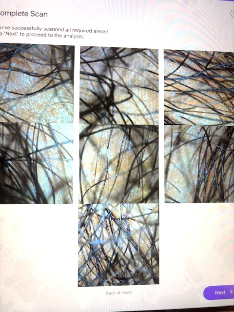 Close-up of tree branches with a light sky background, divided into five vertical sections.
