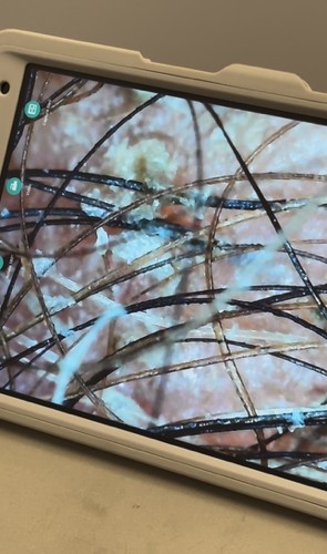 Smartphone screen displays a close-up of tangled dry grass and twigs with a blurred background.