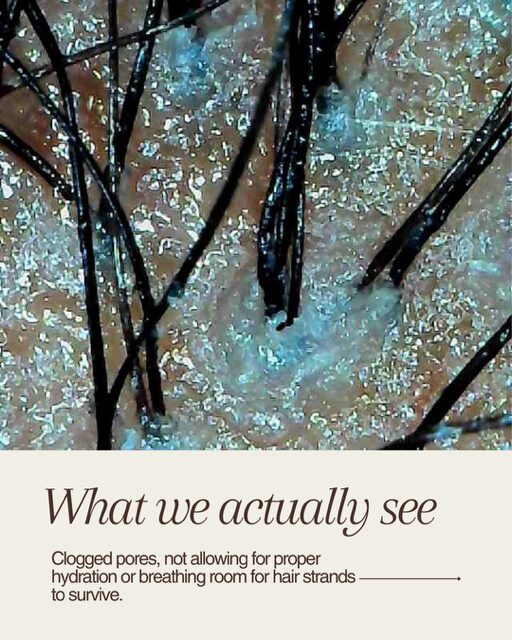 Close-up of clogged hair pores with hair strands and debris, preventing proper hydration and breathing.