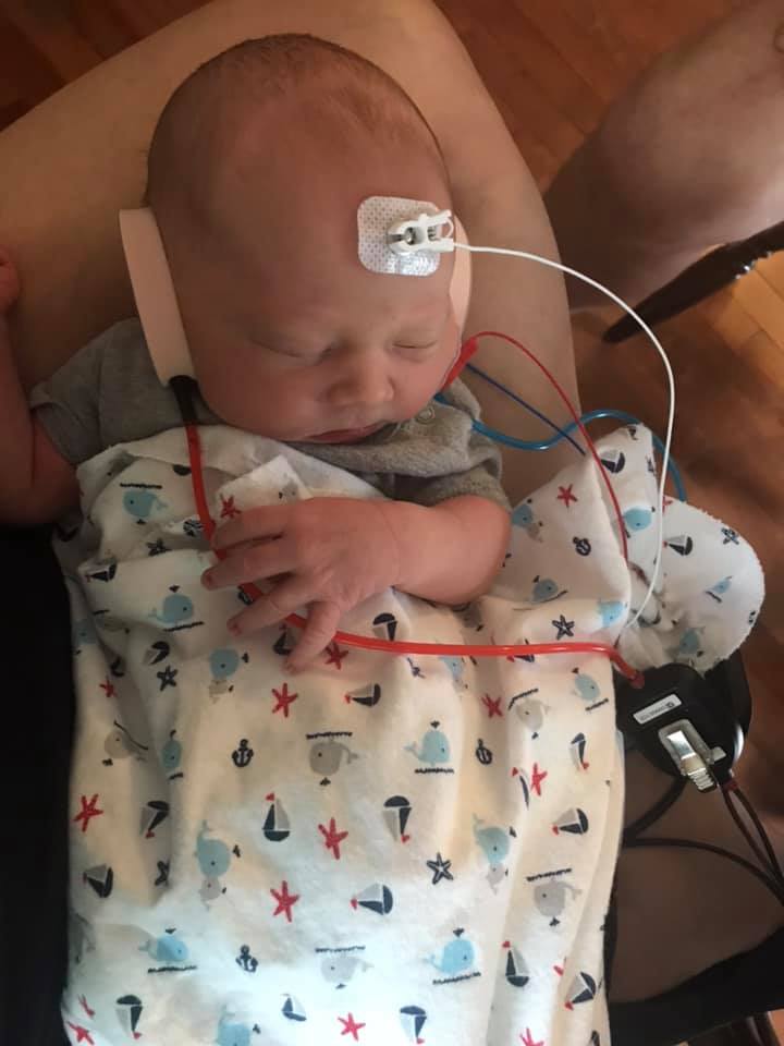Baby with medical wires and a sensor on head, lying on a blanket with nautical patterns, in a hospital setting.