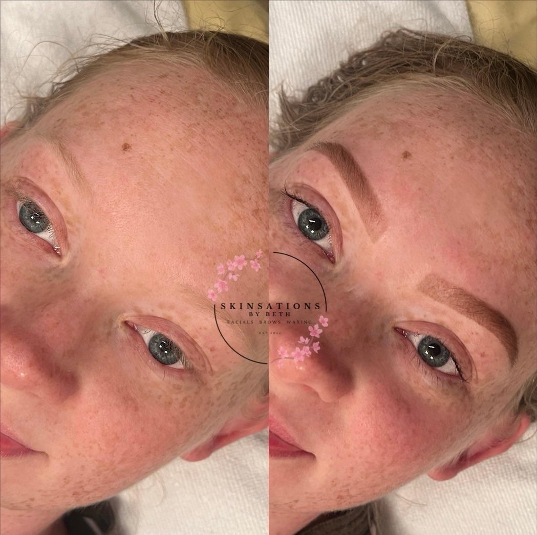 Before and after skincare treatment showing improved skin and eyebrows, side by side, close-up of a woman's face.